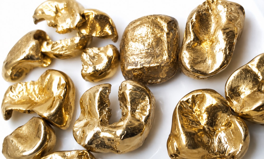 Cast gold inlays, onlays and crowns — guide to selling gold fillings